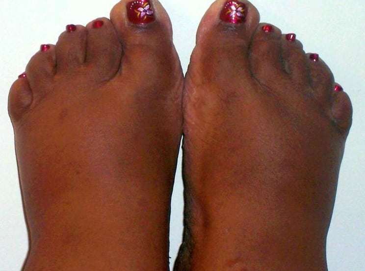 older womens feet